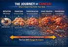 Carcinogenesis: How Your Body Betrays You Cell by Cell (And Why Understanding This Could Save Your Life)
